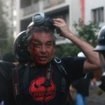 Chile. Los «pacos» tiraron a matar contra los comunicadores populares: dos heridos y varios gaseados adrede