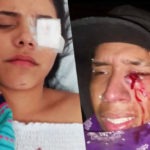 Chile. Escalofriante estela de mutilaciones y heridas deja represión de los «pacos» en el “Súper Lunes”