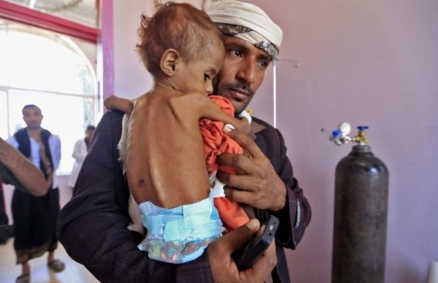 Yemen. Naciones Unidas ignora  el gran sufrimiento humano del pueblo yemenita.