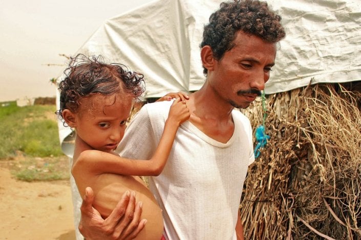 Una hambruna yemení fabricada en Washington y Riad