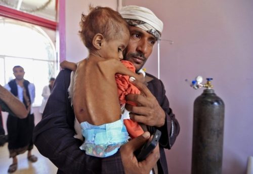 Yemen: Enviado especial de la ONU ignora en su visita el sufrimiento del pueblo (vídeo)