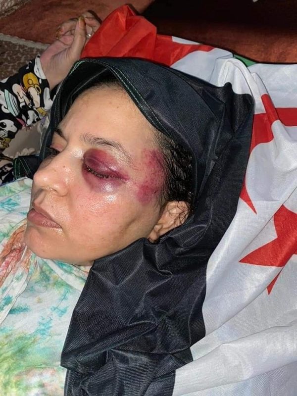 Sáhara Occidental: La policía marroquí agrede repetidamente a la familia de la combatiente Sultana Jaya