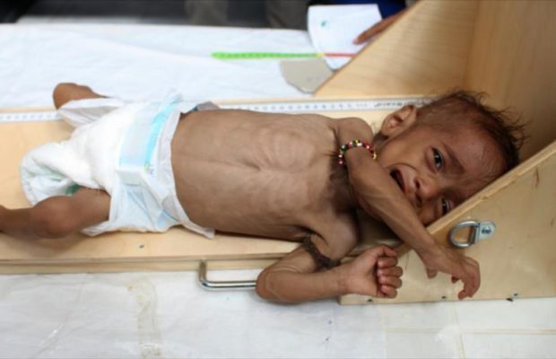 Yemen. ¿Guerra biológica ?: Se dispara cifra de enfermos con cáncer
