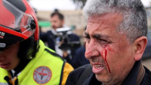 Palestina. Fotógrafo de AP golpeado por la policía israelí en Al-Quds