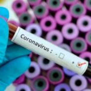 Internacional. La OMS reporta 83.652 casos de coronavirus COVID-19 en el mundo