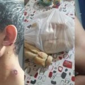Argentina. La Pampa: salió a comprar el pan y la policía le disparó con balas de goma